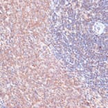 Immunohistochemistry - Anti-TMX Antibody (A89396) - Antibodies.com
