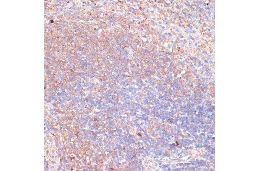 Immunohistochemistry - Anti-TMX Antibody (A89396) - Antibodies.com