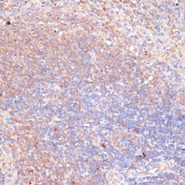 Immunohistochemistry - Anti-TMX Antibody (A89396) - Antibodies.com