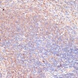 Immunohistochemistry - Anti-TMX Antibody (A89396) - Antibodies.com