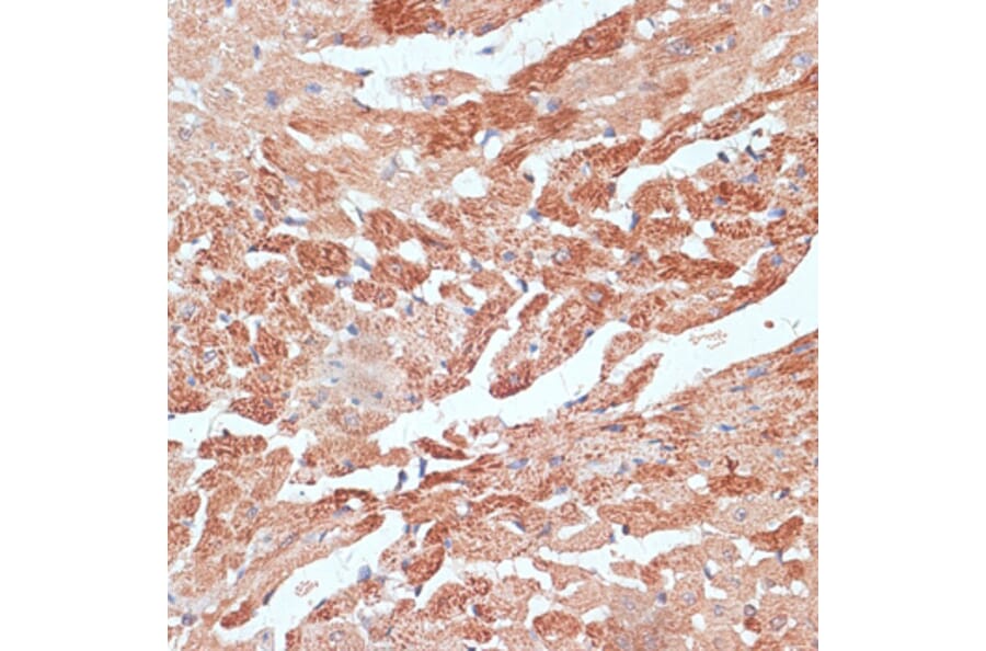Immunohistochemistry - Anti-TMX Antibody (A89396) - Antibodies.com