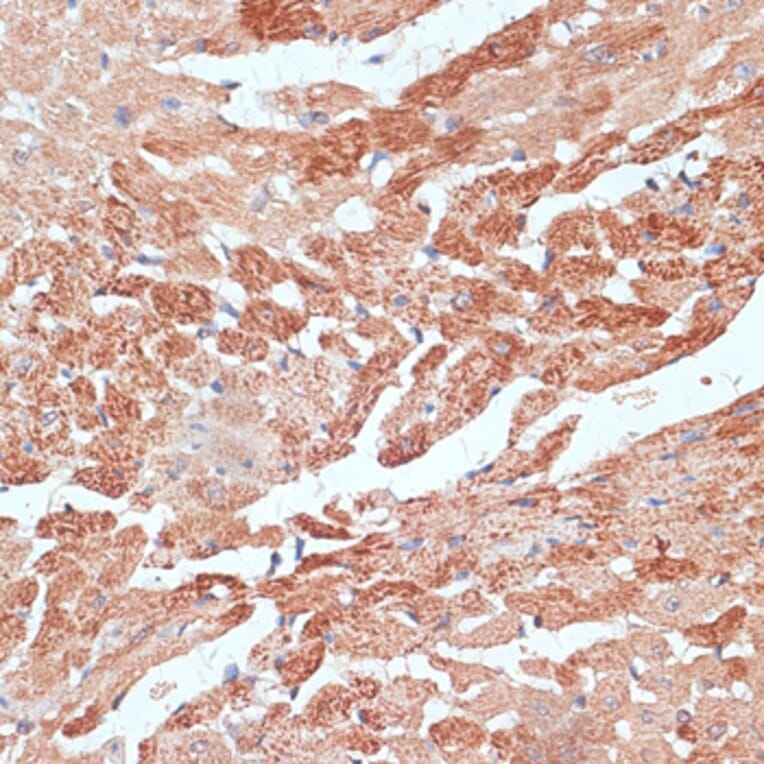 Immunohistochemistry - Anti-TMX Antibody (A89396) - Antibodies.com
