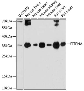 Western blot analysis of extracts of various cell lines, using Anti-PITPNA Antibody (A12966) at 1:3000 dilution.
Secondary antibody: Goat Anti-Rabbit IgG (H+L) (HRP) (AS014) at 1:10,000 dilution.
Lysates / proteins: 25µg per lane.
Blocking buffer: 3% non-fat dry milk in TBST.
Detection: ECL Basic Kit (RM00020).
Exposure time: 60s.