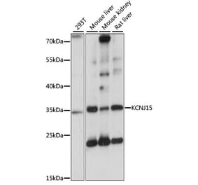 Western Blot - Anti-KCNJ15 Antibody (A89398) - Antibodies.com