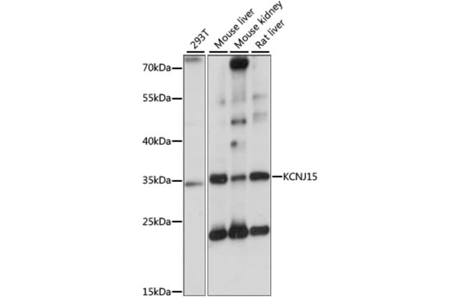 Western Blot - Anti-KCNJ15 Antibody (A89398) - Antibodies.com