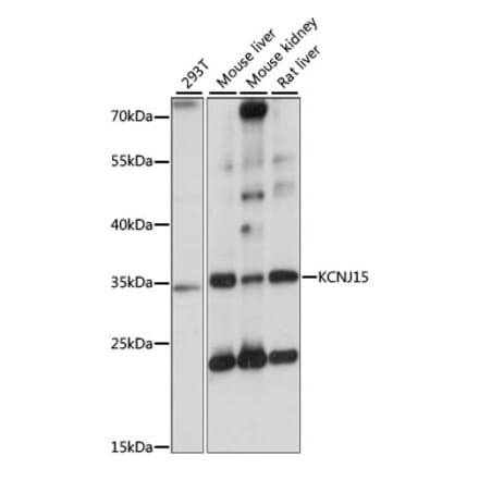 Western Blot - Anti-KCNJ15 Antibody (A89398) - Antibodies.com