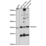 Western Blot - Anti-KCNJ15 Antibody (A89398) - Antibodies.com