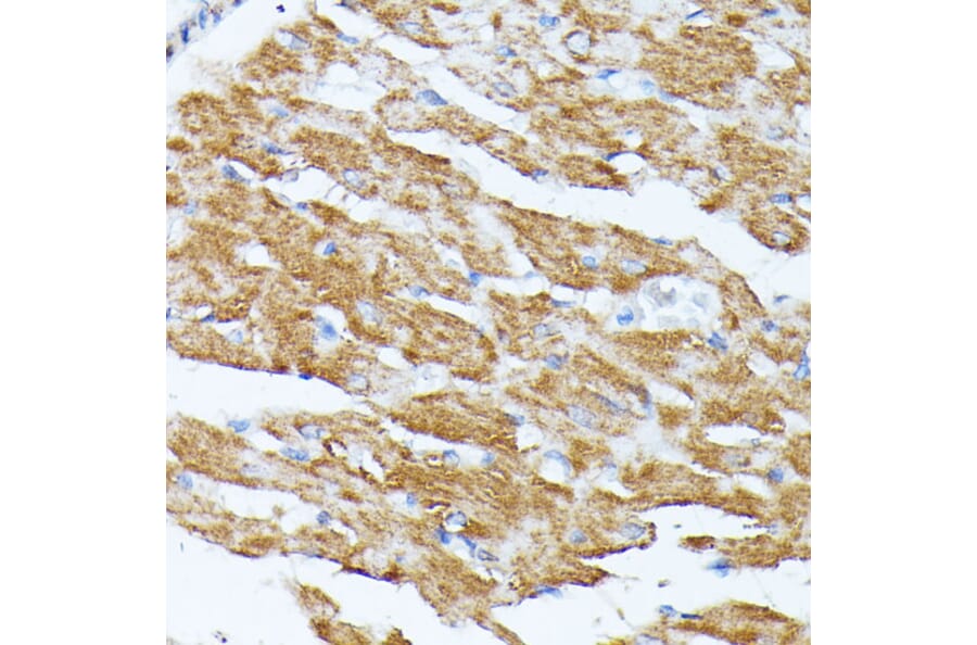 Immunohistochemistry - Anti-KCNJ15 Antibody (A89398) - Antibodies.com