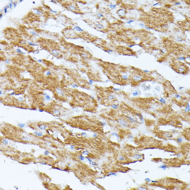 Immunohistochemistry - Anti-KCNJ15 Antibody (A89398) - Antibodies.com