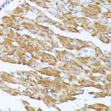 Immunohistochemistry - Anti-KCNJ15 Antibody (A89398) - Antibodies.com