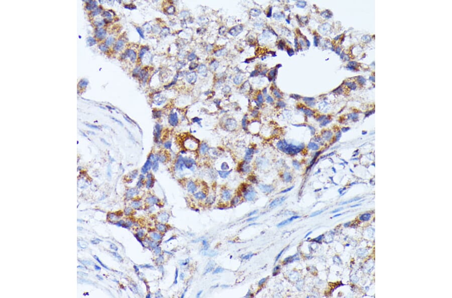 Immunohistochemistry - Anti-KCNJ15 Antibody (A89398) - Antibodies.com