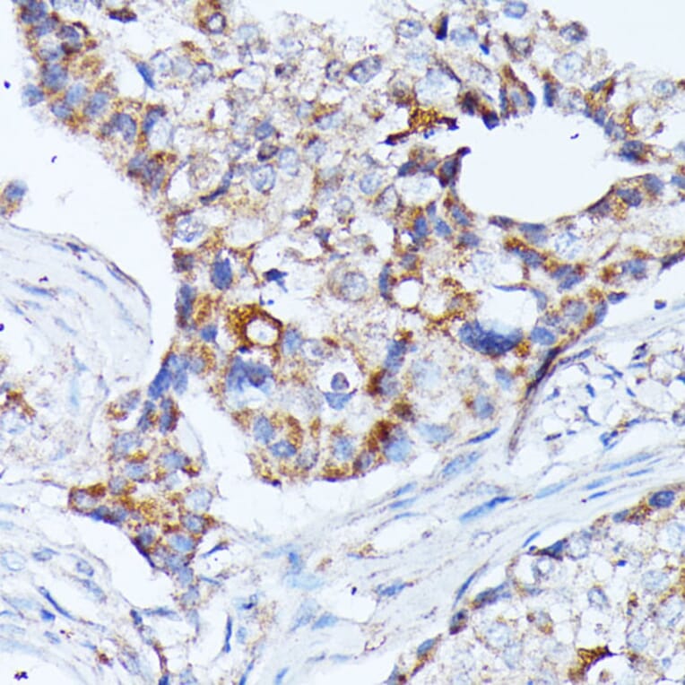Immunohistochemistry - Anti-KCNJ15 Antibody (A89398) - Antibodies.com