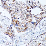 Immunohistochemistry - Anti-KCNJ15 Antibody (A89398) - Antibodies.com
