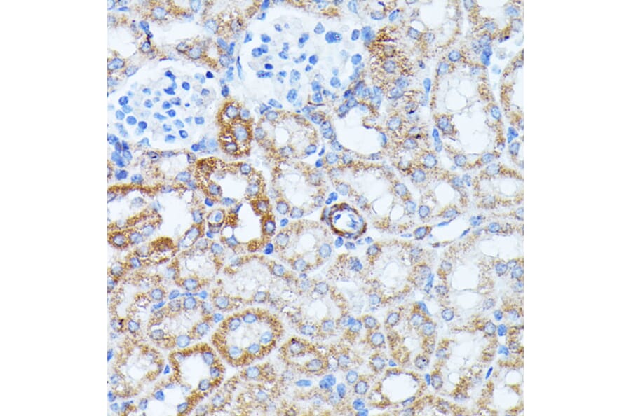 Immunohistochemistry - Anti-KCNJ15 Antibody (A89398) - Antibodies.com