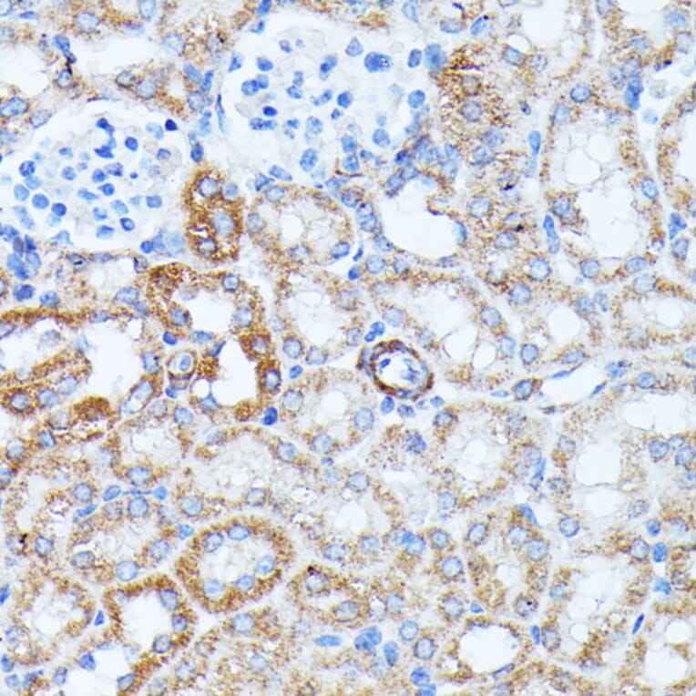 Immunohistochemistry - Anti-KCNJ15 Antibody (A89398) - Antibodies.com