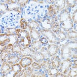 Immunohistochemistry - Anti-KCNJ15 Antibody (A89398) - Antibodies.com