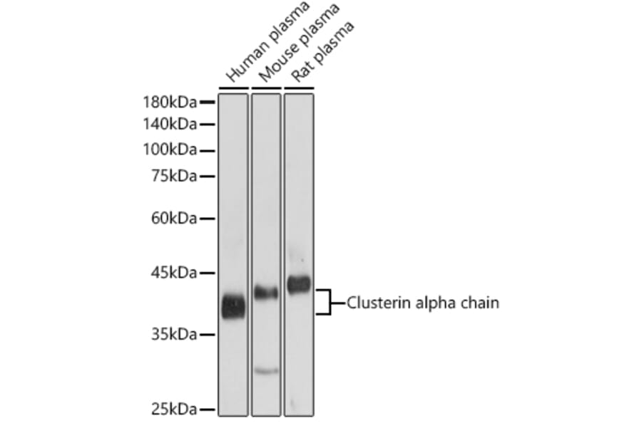 Western Blot - Anti-Clusterin Antibody (A89399) - Antibodies.com