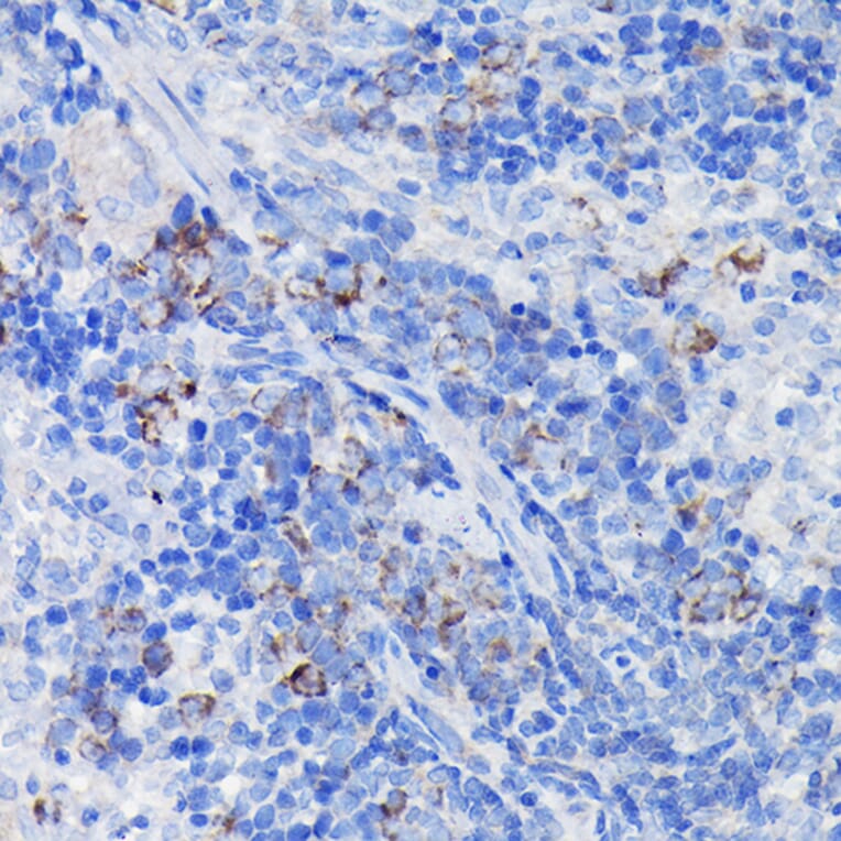 Immunohistochemistry - Anti-Clusterin Antibody (A89399) - Antibodies.com