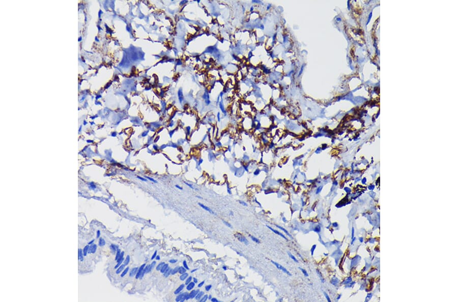 Immunohistochemistry - Anti-Clusterin Antibody (A89399) - Antibodies.com