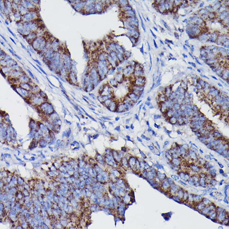 Immunohistochemistry - Anti-Clusterin Antibody (A89399) - Antibodies.com