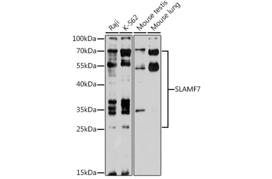 Western Blot - Anti-SLAMF7/CS1 Antibody (A89400) - Antibodies.com