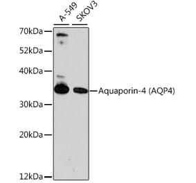 Western Blot - Anti-Aquaporin 4 Antibody (A89402) - Antibodies.com
