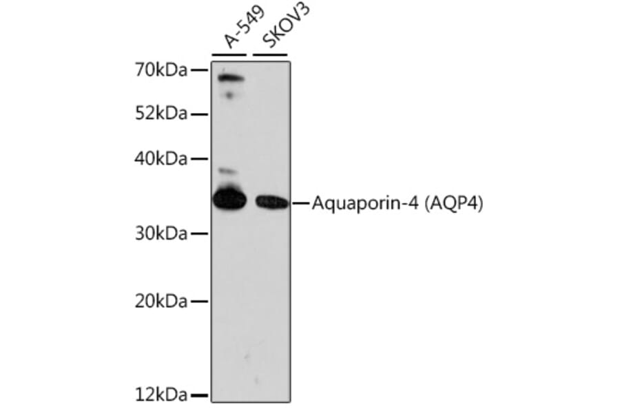 Western Blot - Anti-Aquaporin 4 Antibody (A89402) - Antibodies.com
