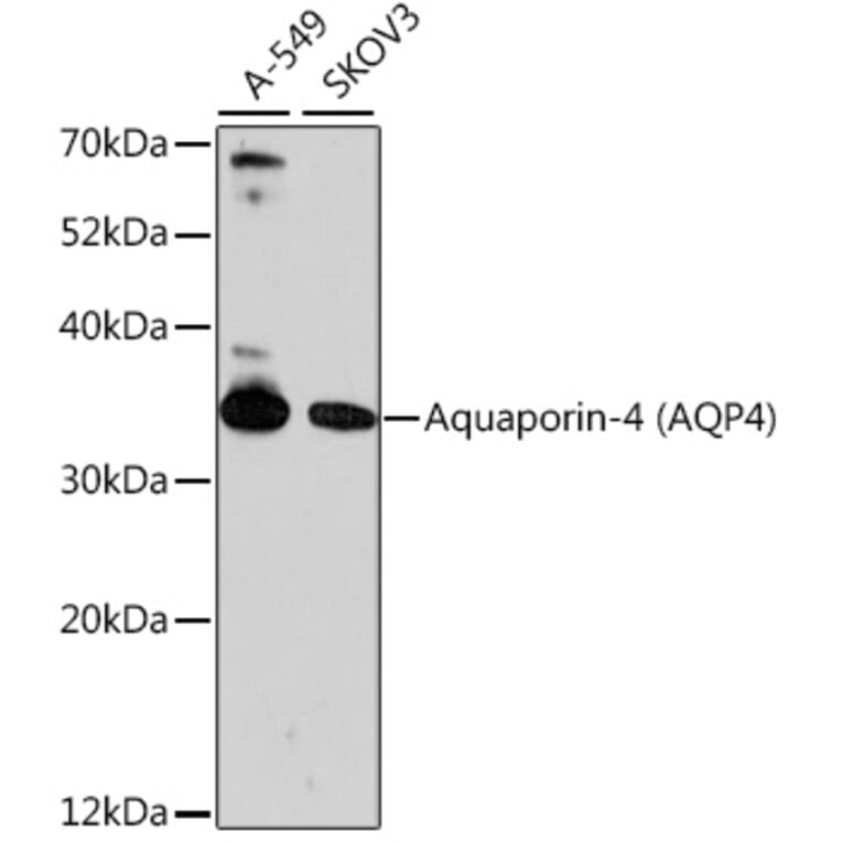 Western Blot - Anti-Aquaporin 4 Antibody (A89402) - Antibodies.com