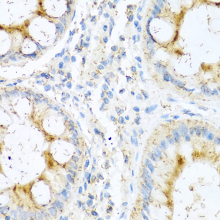 Immunohistochemistry - Anti-NTF4 Antibody (A0912) - Antibodies.com