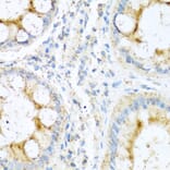 Immunohistochemistry - Anti-NTF4 Antibody (A0912) - Antibodies.com