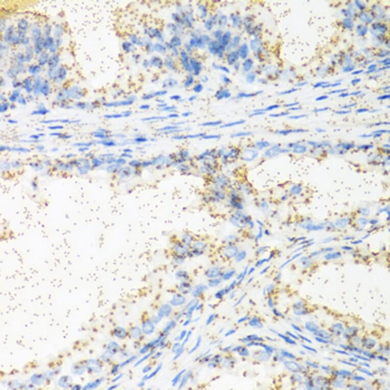 Immunohistochemistry - Anti-NTF4 Antibody (A0912) - Antibodies.com