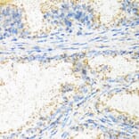 Immunohistochemistry - Anti-NTF4 Antibody (A0912) - Antibodies.com