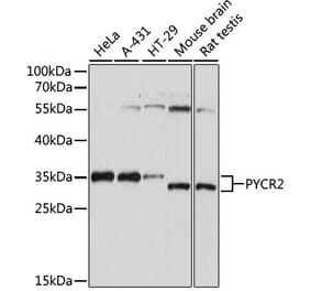 Western Blot - Anti-PYCR2 Antibody (A89404) - Antibodies.com