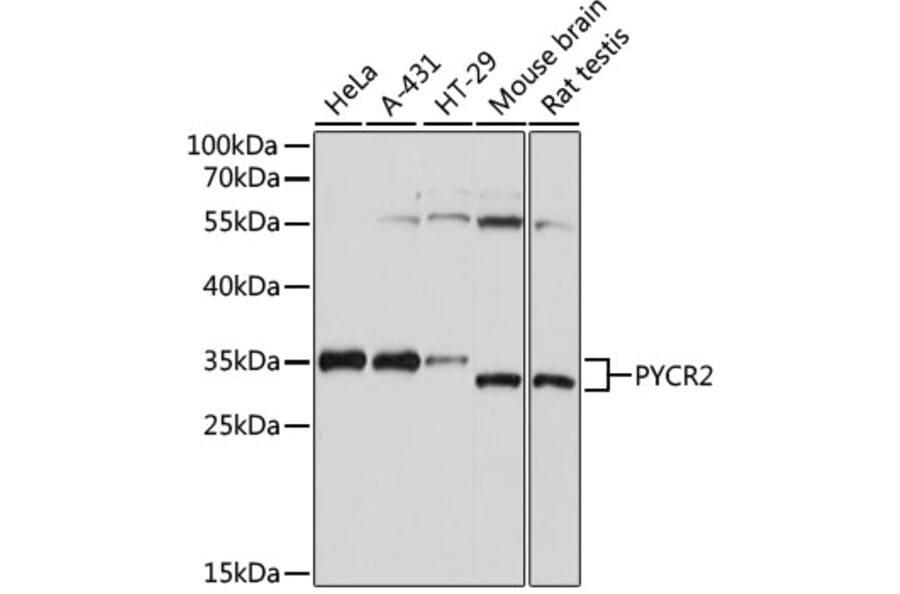 Western Blot - Anti-PYCR2 Antibody (A89404) - Antibodies.com
