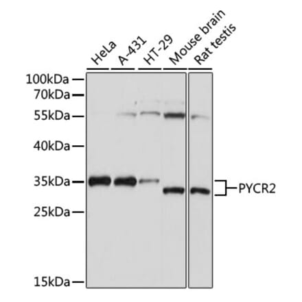 Western Blot - Anti-PYCR2 Antibody (A89404) - Antibodies.com