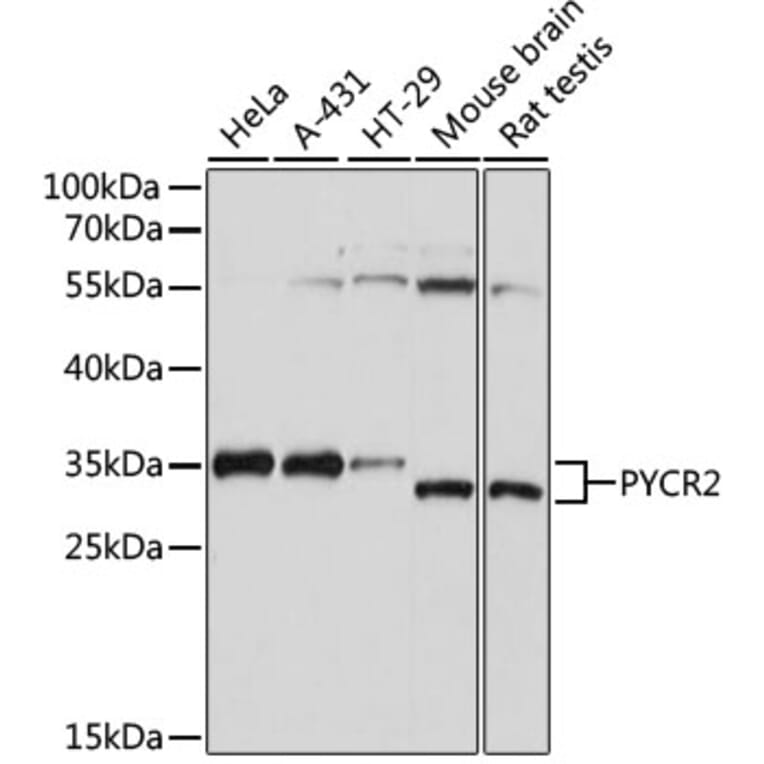 Western Blot - Anti-PYCR2 Antibody (A89404) - Antibodies.com