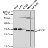 Western Blot - Anti-PYCR2 Antibody (A89404) - Antibodies.com