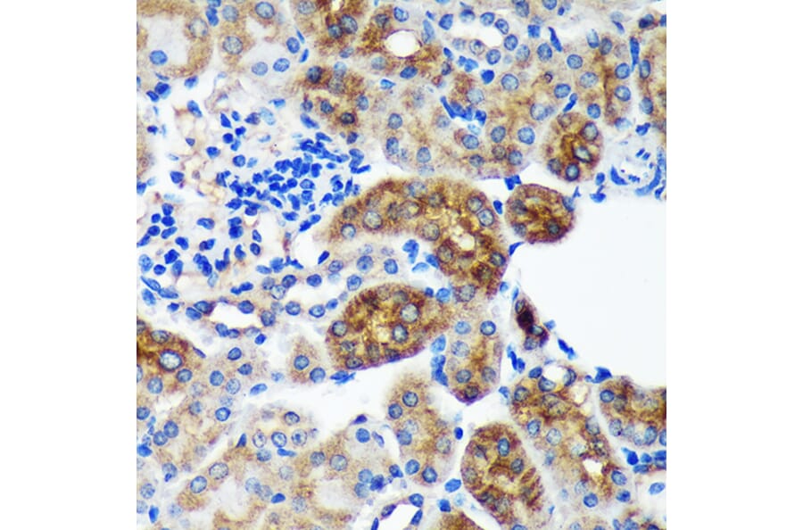 Immunohistochemistry - Anti-PYCR2 Antibody (A89404) - Antibodies.com