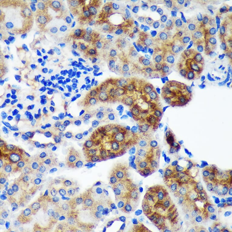 Immunohistochemistry - Anti-PYCR2 Antibody (A89404) - Antibodies.com
