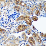 Immunohistochemistry - Anti-PYCR2 Antibody (A89404) - Antibodies.com