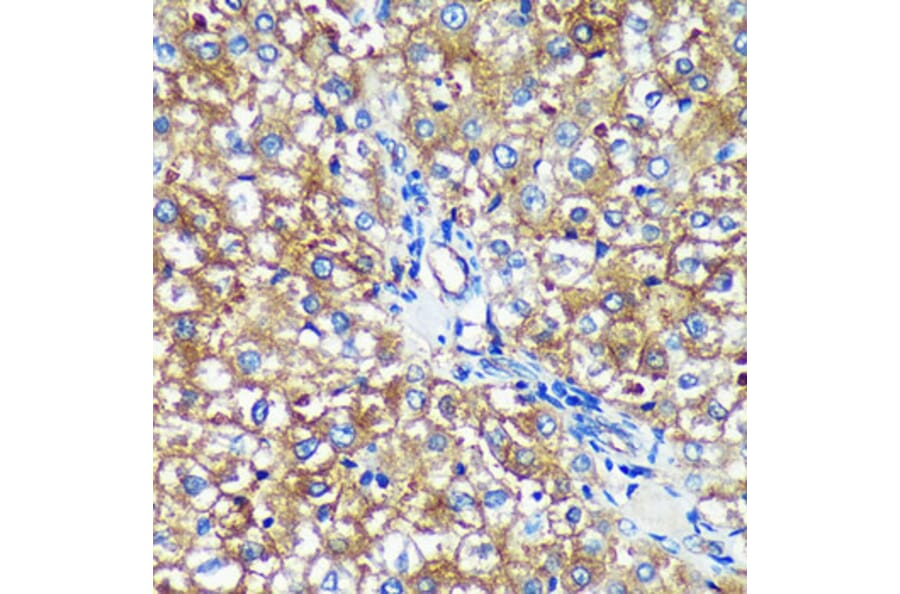 Immunohistochemistry - Anti-PYCR2 Antibody (A89404) - Antibodies.com