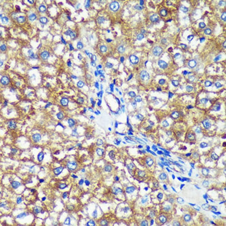 Immunohistochemistry - Anti-PYCR2 Antibody (A89404) - Antibodies.com