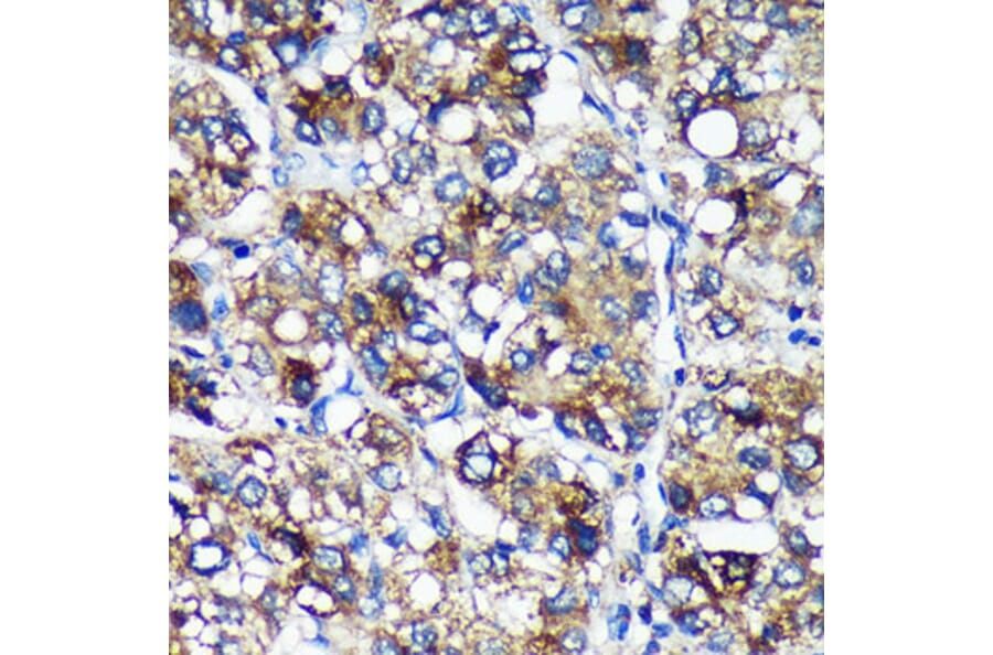 Immunohistochemistry - Anti-PYCR2 Antibody (A89404) - Antibodies.com
