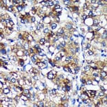 Immunohistochemistry - Anti-PYCR2 Antibody (A89404) - Antibodies.com