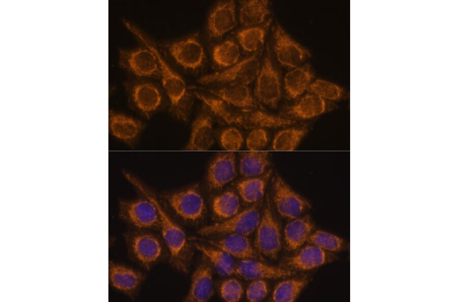 Immunofluorescence - Anti-PYCR2 Antibody (A89404) - Antibodies.com