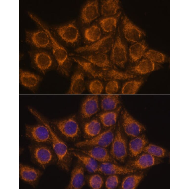 Immunofluorescence - Anti-PYCR2 Antibody (A89404) - Antibodies.com