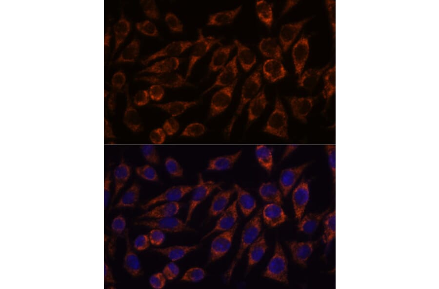 Immunofluorescence - Anti-PYCR2 Antibody (A89404) - Antibodies.com