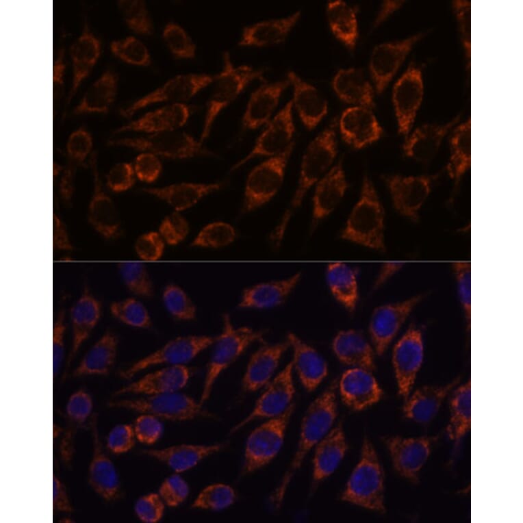 Immunofluorescence - Anti-PYCR2 Antibody (A89404) - Antibodies.com