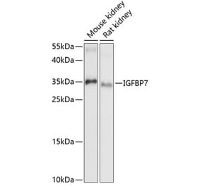 Western Blot - Anti-IGFBP7 Antibody (A89405) - Antibodies.com