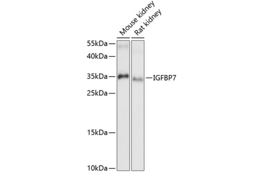 Western Blot - Anti-IGFBP7 Antibody (A89405) - Antibodies.com